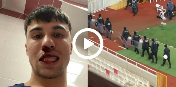 Shock in Turchia: invasione e pugno ad un calciatore Viola, interviene la polizia!